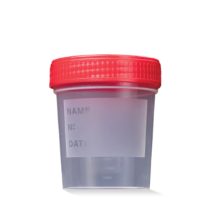 Urine Collection Cup (125ml)